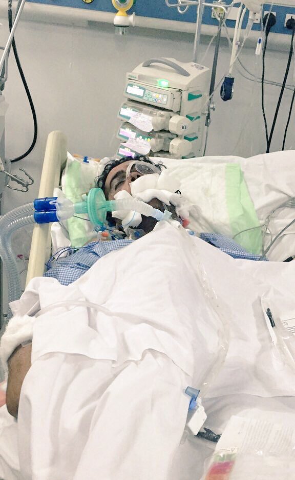 wabranali's tweet photo. مهدي تعرض لحادث يعاني كسور في الوجه وفقدانه لاحدى عيناه وبحاجه لاخلاء طبي ووالده المرابط على الحد يناشد ولاة الامر https://t.co/YXOzKekmA4