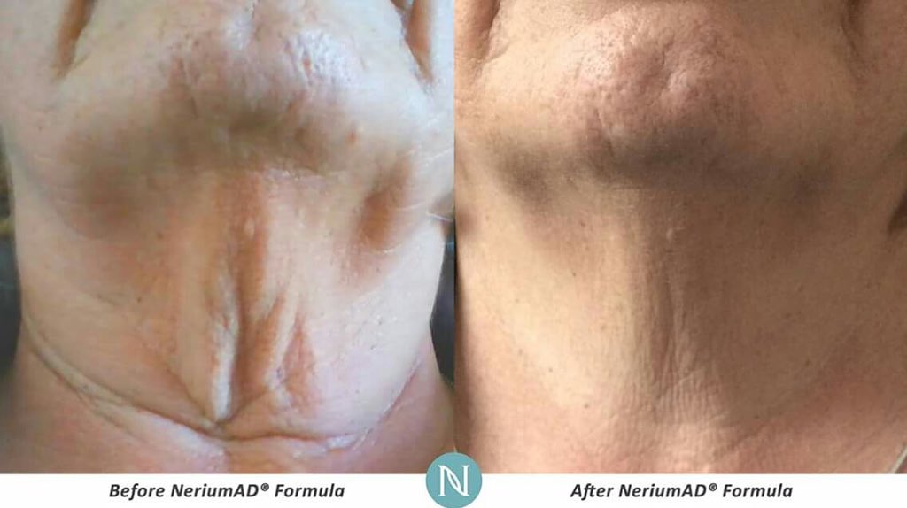 90 DAY REAL RESULTS! #Nerium Look young #YudiPedraza https://t.co/c2ab02R9pn https://t.co/LnVoc6ibum