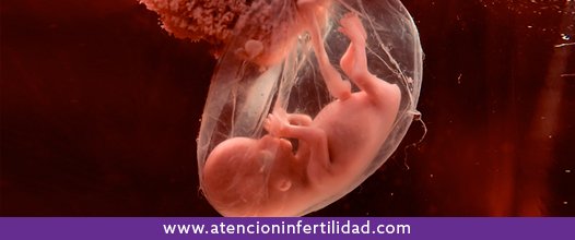 Todo lo que necesitas saber del aborto involuntario #Embarazo #Infertilidad #Salud bit.ly/1XPIn6u