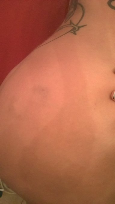 Can you see the bite Mark? https://t.co/B0vNQmn3gU