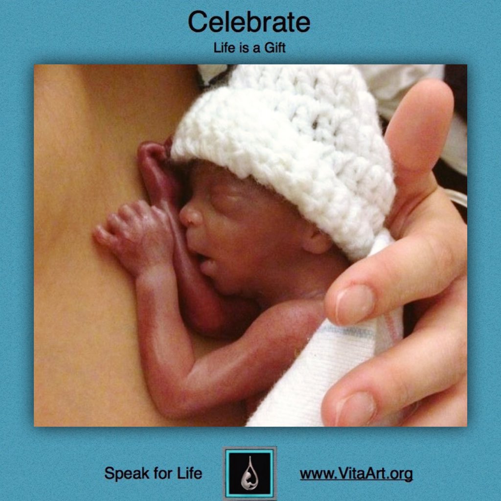 VitaArtJewelry's tweet photo. Pre-mature #22week baby #preborn #alive #prolife #Letvitaspeak #sonogram #womb #beavoiceforthevoiceless #chooselife https://t.co/FDVjtCbvZj