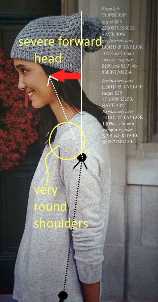 posturevideos's tweet image. This year&apos;s fashion statement: Once you&apos;ve dressed your model #topshop get her to a chiropractor stat! #modelposture