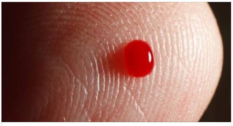 Google Files Patent For Needle-Free Blood-Drawing Smartwatch - keepuinformed.com/google-files-p…