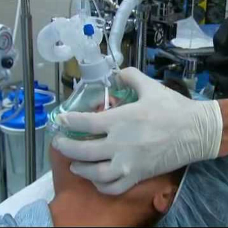 drGiorgiaRatta's tweet image. With @SilhouetteSoft #ThreadsLift there is NO need for general anaesthetic. #safetyinbeauty #aesthetics #antiageing