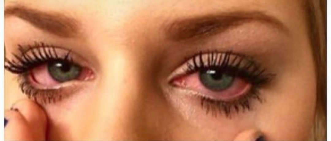 Police officer "are you high"
Me "no officer just allergies"