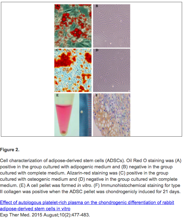 I'm liking "Stem cells are the seeds &amp; PRP is the fertilizer" analogy more &amp; more!  <a href="/RestorePDX/">RestorePDX</a> #PRP #stemcells