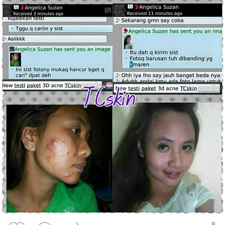 mulusdotcom's tweet image. tcskin.blogspot.com
Info order : 
bbm 5800e3f3 
Line id mulus.com
WA. 08568465656