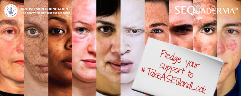 SEQuaderma's tweet photo. Join @SEQuaderma and @BSFcharity in challenging appearance perception: https://t.co/KlMtrgLwSM #TakeASEQondLook https://t.co/QgZ9XBkiqe