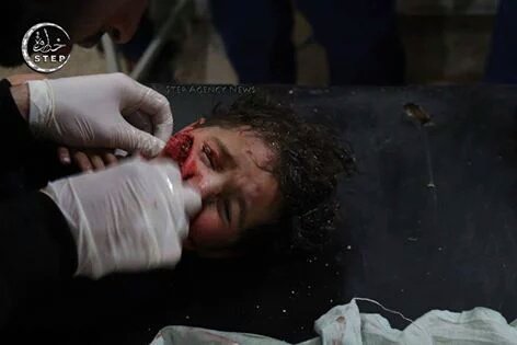 doamuslims's tweet photo. Children wounded due to #Russia airstrikes on al-Bezeinah village, #Idlib.

#Syria #DontBombSyria https://t.co/NDxHhKH04G