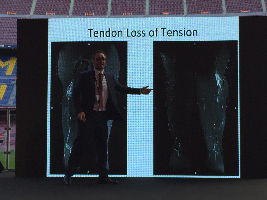 DocQuiceno's tweet image. @muscletechnetwo @XValle_Dr @TilLluis 👍🏽😄⚽️👏🏽 Excellent 🏆@FCBarcelona_cat  @Aspetar @footballmed 💯🔝 #MTNECOSEP