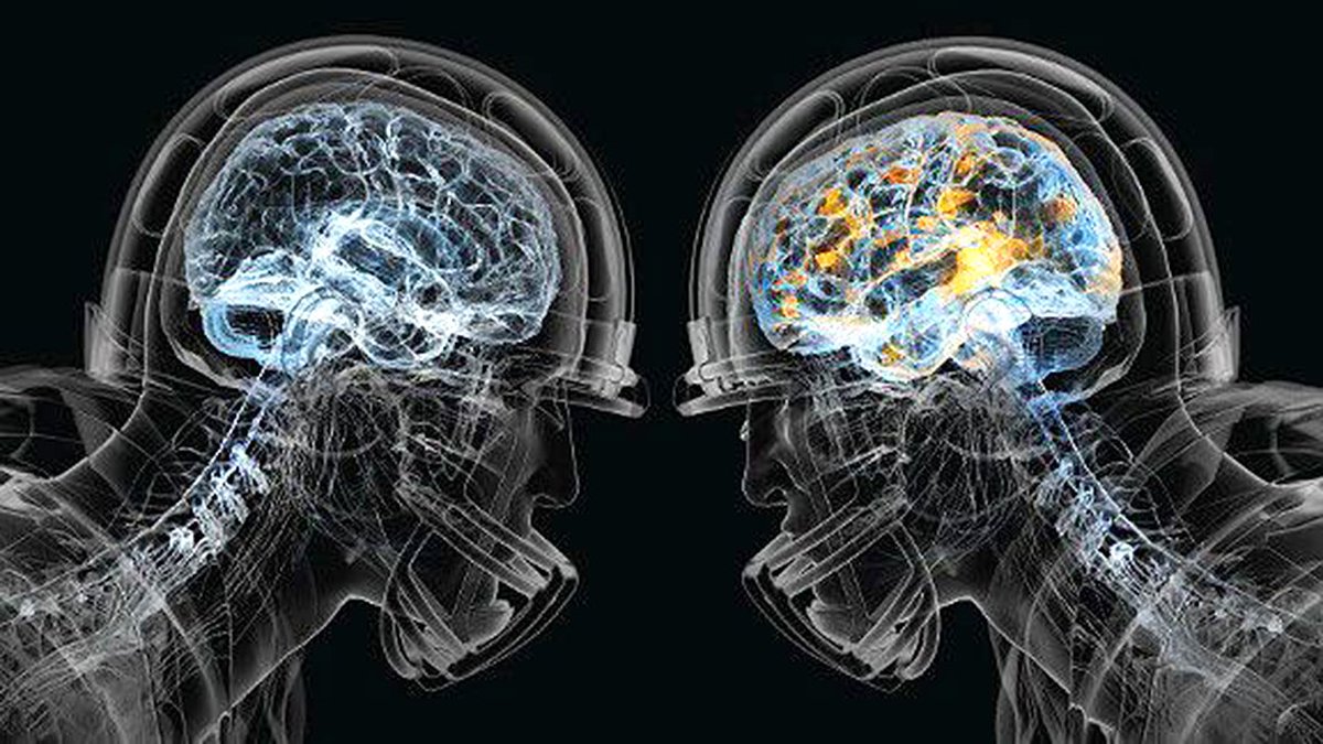 espn's tweet photo. Sources: NFL backs out of funding study on relationship between football and brain disease: https://t.co/kmhdiXUvA8 https://t.co/UN8EXBgryP