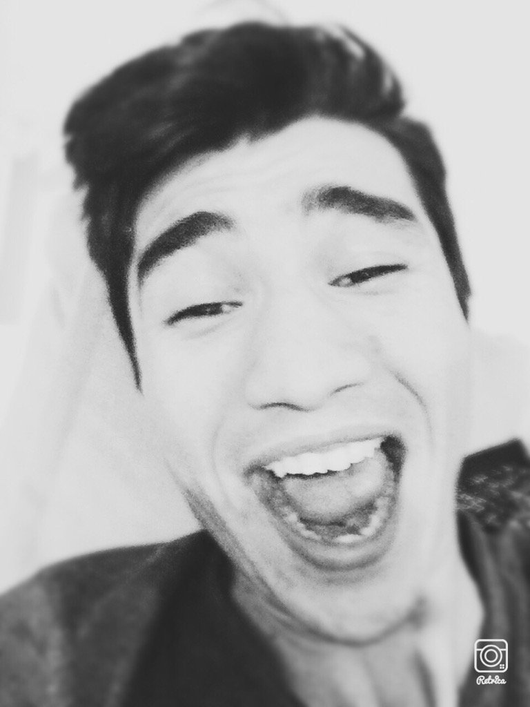 Dişçi ağzını aç dediğinde ben.