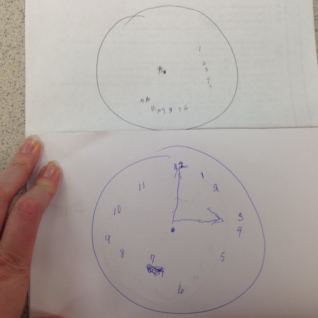 WhatIsMySLPLife's tweet photo. First day... Now. #clock #clockdrawing #dementia https://t.co/0crUzVBNZg
