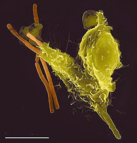 CerebroDigital1's tweet photo. Neutrófilo fagocitando a la bacteria que produce el carbunco(Bacillus anthracis) . https://t.co/INDAt8wkVi