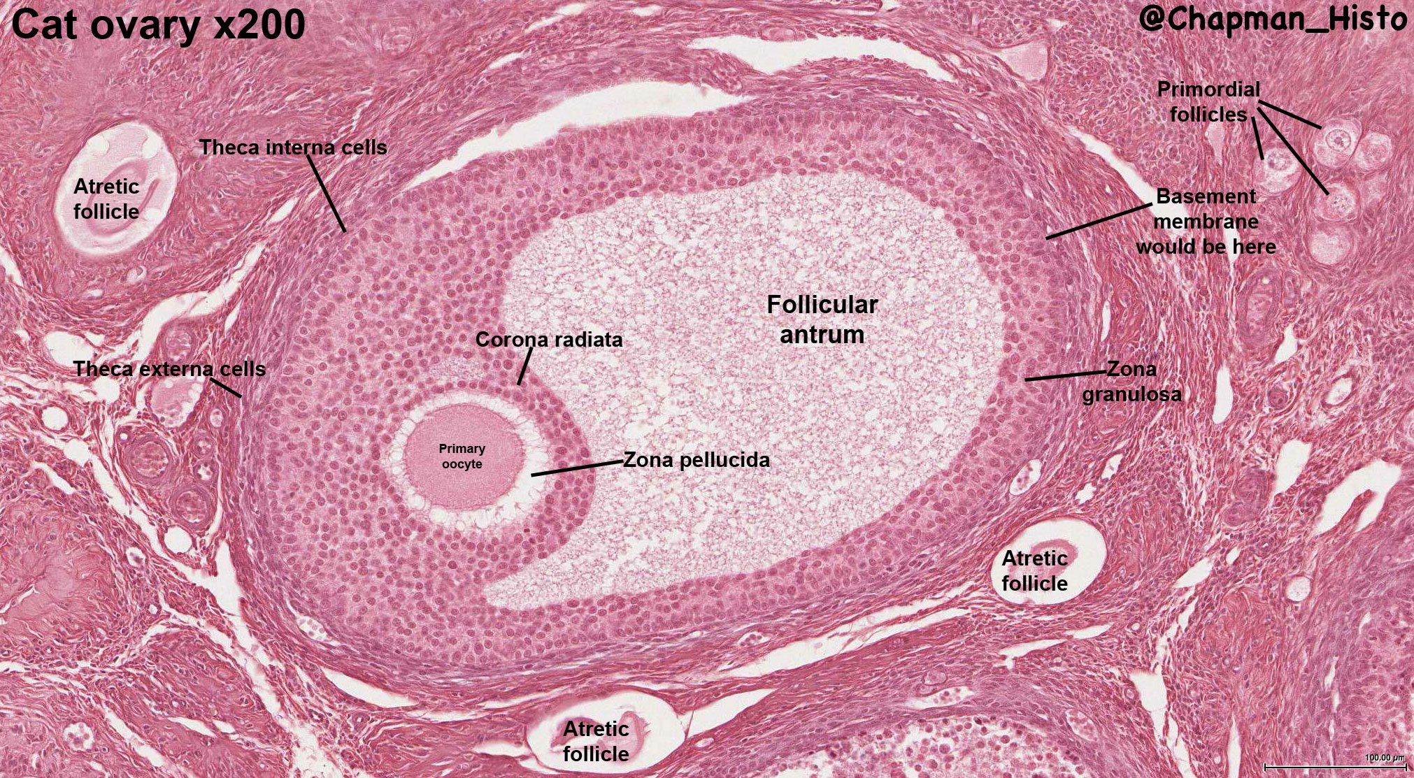 Ovary Histology Labeled