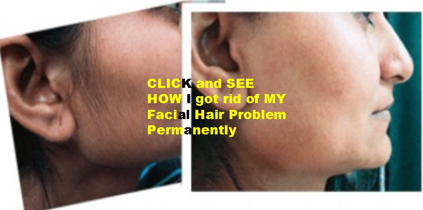 HairPermanent's tweet photo. ayurvedic permanent hair removal cream #Jodhpur
#panchkula
#Ajmer
#Erode
#Ahmedabad
->https://t.co/H8AZvdpVXY https://t.co/iPRMmSkI8P