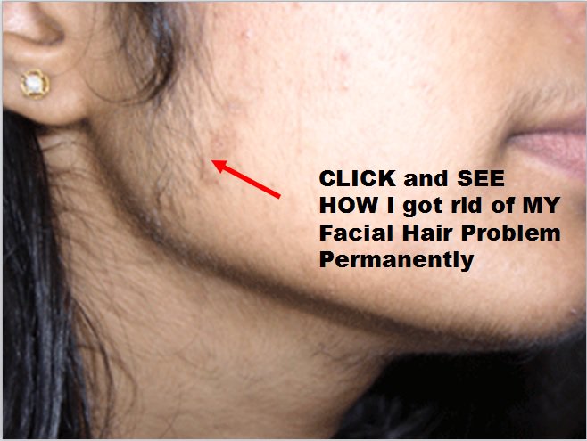 Permanent removal of unwanted hair naturally  Ayurveda