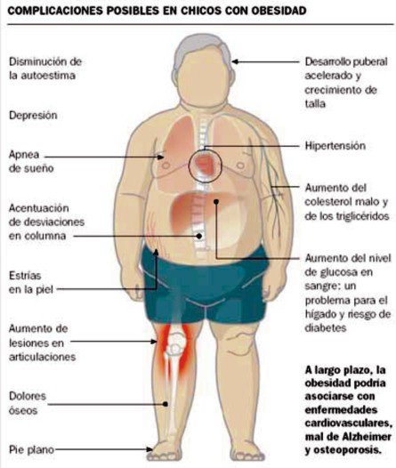 cparitarioUBB's tweet photo. La obesidad infantil mata, cuida a los tuyos @ddeubiobio @ubbchile https://t.co/Acm6enfq7R