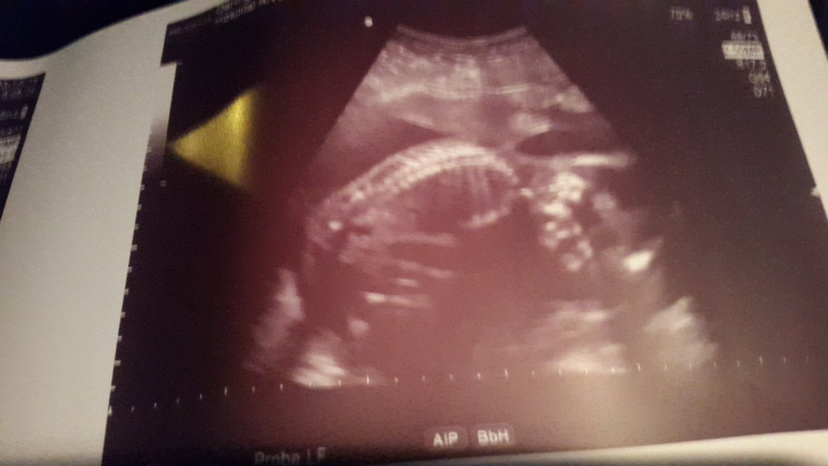 Kelly bennett tweet media