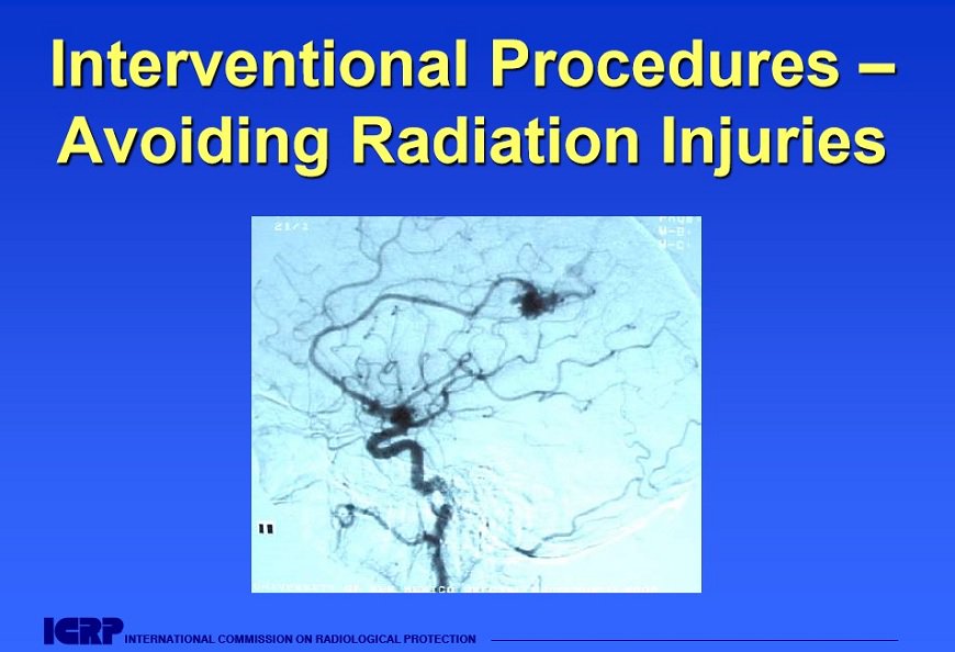 e_Radiologia's tweet photo. #InterventionalProcedures: Avoiding Radiation Injuries - https://t.co/8flDMqQm31 https://t.co/F1nRGREWI9