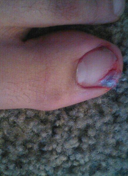 Jaay_TG's tweet photo. Look what happens when u run up the stairs .. Kids don't try this at home https://t.co/bttfRFbdoC