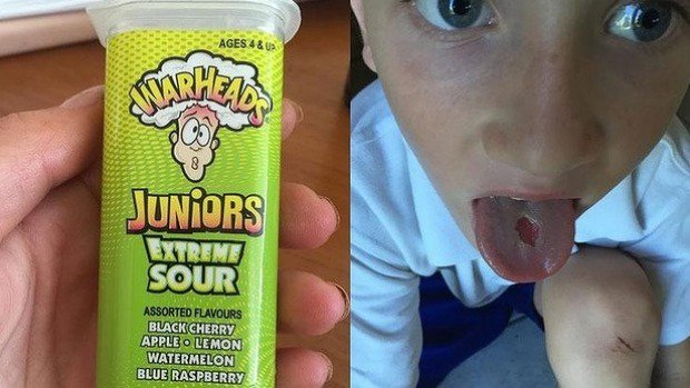 Audio_Books_'s tweet photo. Extreme Sour Warhead candy burns burns a hole in boy's tongue.  Imagine his stomach. https://t.co/6OpHHmcLuo https://t.co/1idpeyR0Ql