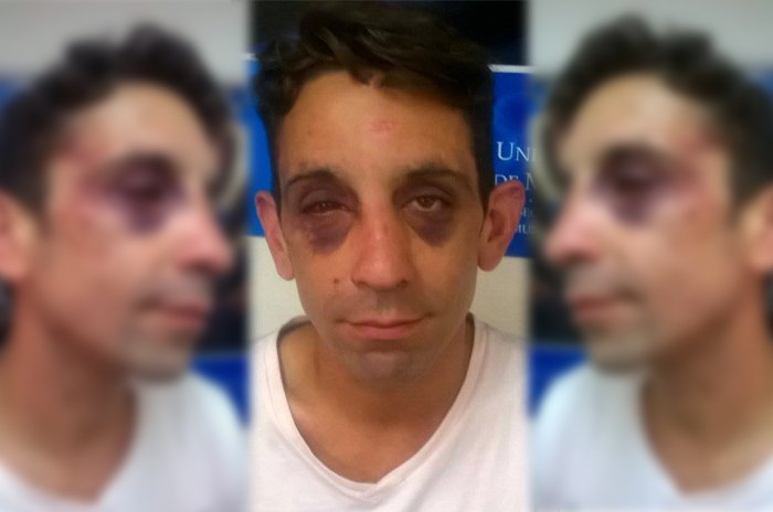 quedigital1's tweet photo. Golpearon a joven activista gay en Moreno y Santa Fe: #Neonazis frente a otra denuncia
► https://t.co/KkL4ZmDqLW https://t.co/aikNBrAg4q