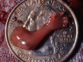 abortionNO_zzz's tweet photo. 10 week abortion. #abortionNO https://t.co/RyzIySFn1Z