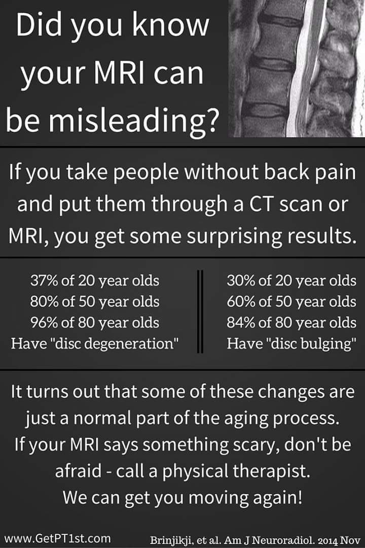 GetPT1st's tweet photo. .@BJSM_BMJ here are a couple graphics we made from research data to share with the public. #GetPT1st https://t.co/W1jeeKp3LY