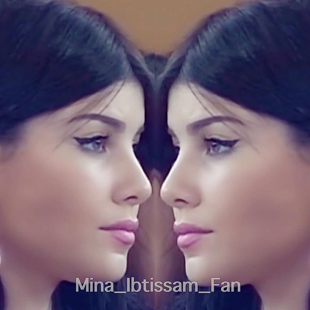 ibtissamoc's tweet photo. #Thanks1DForInfinityVideo
Follow plz
ππππ
@HananeElKhader
#HananeElKhader https://t.co/zAT5AnHgWt