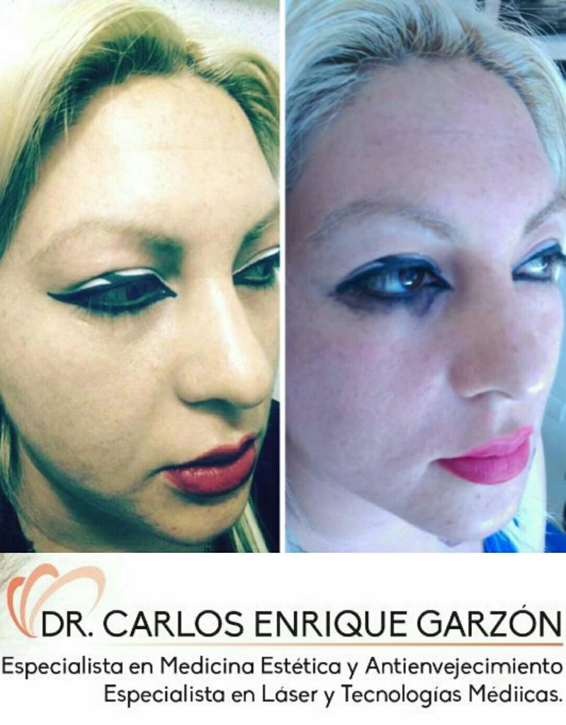 RICKYCRAZY4U2's tweet photo. #antiaging  #aesthetic #health #HealthForAll #healthcare #young https://t.co/KkDH4tVOY0
