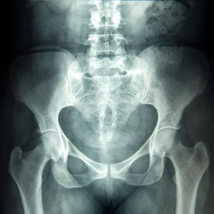 WomensHealthMag's tweet photo. 7 WTF "cures" for horniness throughout history: https://t.co/qHeahkUu6w https://t.co/bzBt0ILZCQ