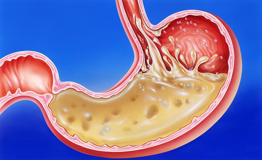 Did You Know On Twitter If Your Stomach Acid Got Onto Your Skin It Would Burn A Hole In It Https T Co Uk2u7rxdsl Twitter Did You Know On Twitter If Your Stomach Acid Got Onto Your Skin It Would Burn A Hole In It Https T Co Uk2u7rxdsl Twitter