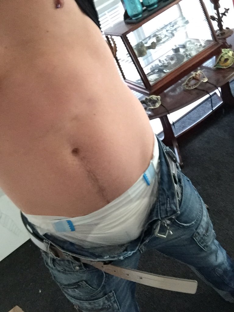 bedwetDL's tweet photo. Will anyone notice #backindiapers #wet #public #nappy #gay #adbl  #bedwetter https://t.co/d2Rx6m5Jre