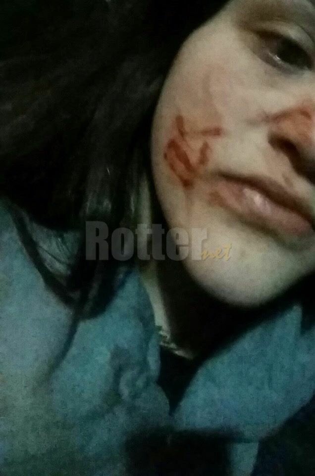 SagiOrli's tweet photo. U will not see this on the news Israeli have been attack by 2 #femaleTerrorists ended with broken nose&cuts on face https://t.co/t5dMcODib5