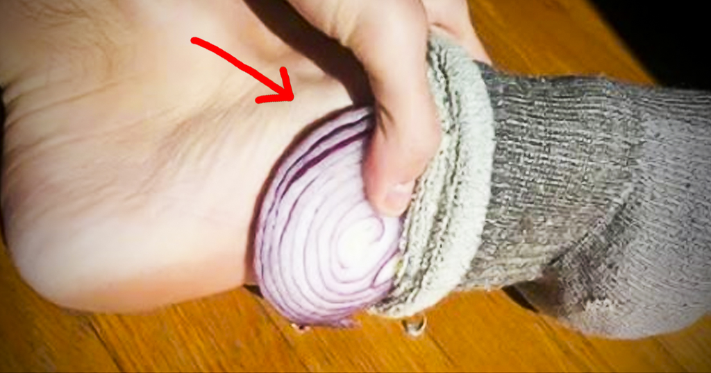 She Sleeps With Sliced Raw Onions In Her Socks. Wait  Till You See The Benefits. shares-that.rocks/sheci-sleeps-s…