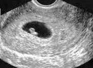 My angel is so tiny. I'm in love. 😍