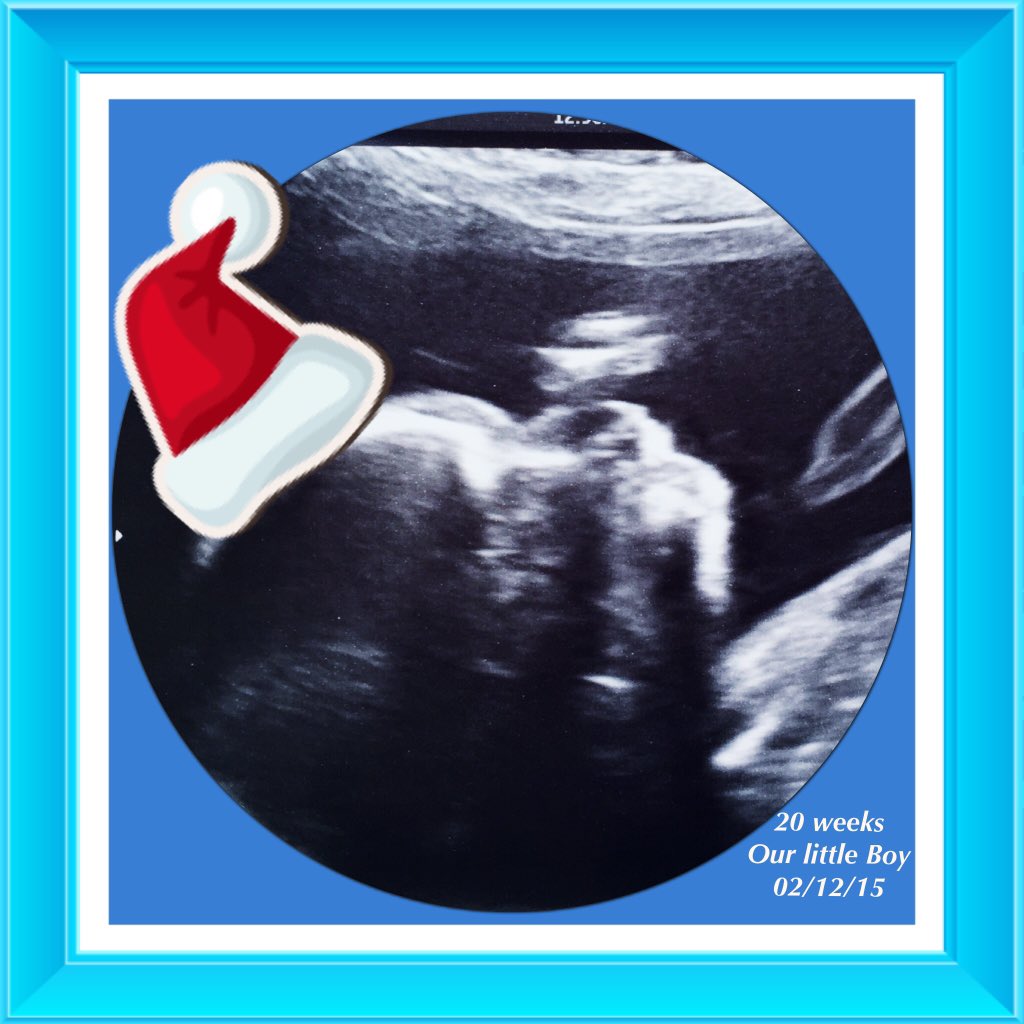 josiethomson2's tweet photo. My little man 20weeks. Merry Christmas xxx https://t.co/p14KBaicSj
