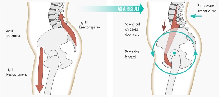 SJSportTherapy's tweet photo. Posture assessment &amp; muscle length test should be used to determine the problem

#hamstring #backpain #physioyorks https://t.co/jVlQdCcBSZ