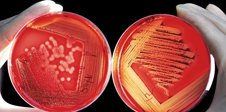 Labiotech_eu's tweet photo. World’s First Microbiome Fund Swells to €160M With #Novartis now Also Chipping In #Seventure https://t.co/DYjFvabjE7 https://t.co/m0wBEn5syO
