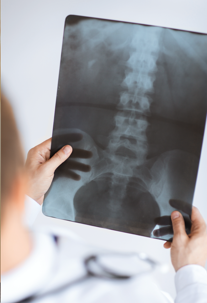 NJ_SPINE's tweet photo. What are the benefits of Minimally Invasive #Spine Surgery?  #spinesurgery #backsurgery
https://t.co/Hre46lNvak https://t.co/h50wyc38mM