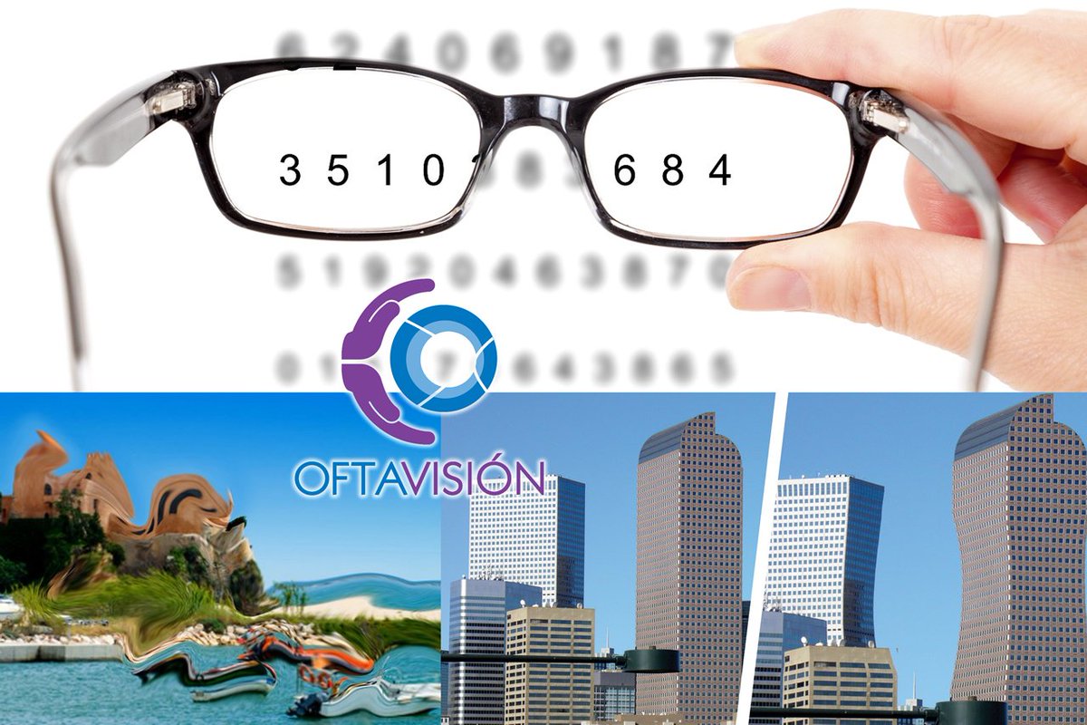 El Astigmatismo es un defecto refractivo del ojo que ocasiona falta de nitidez en la visión de lejos y de cerca.