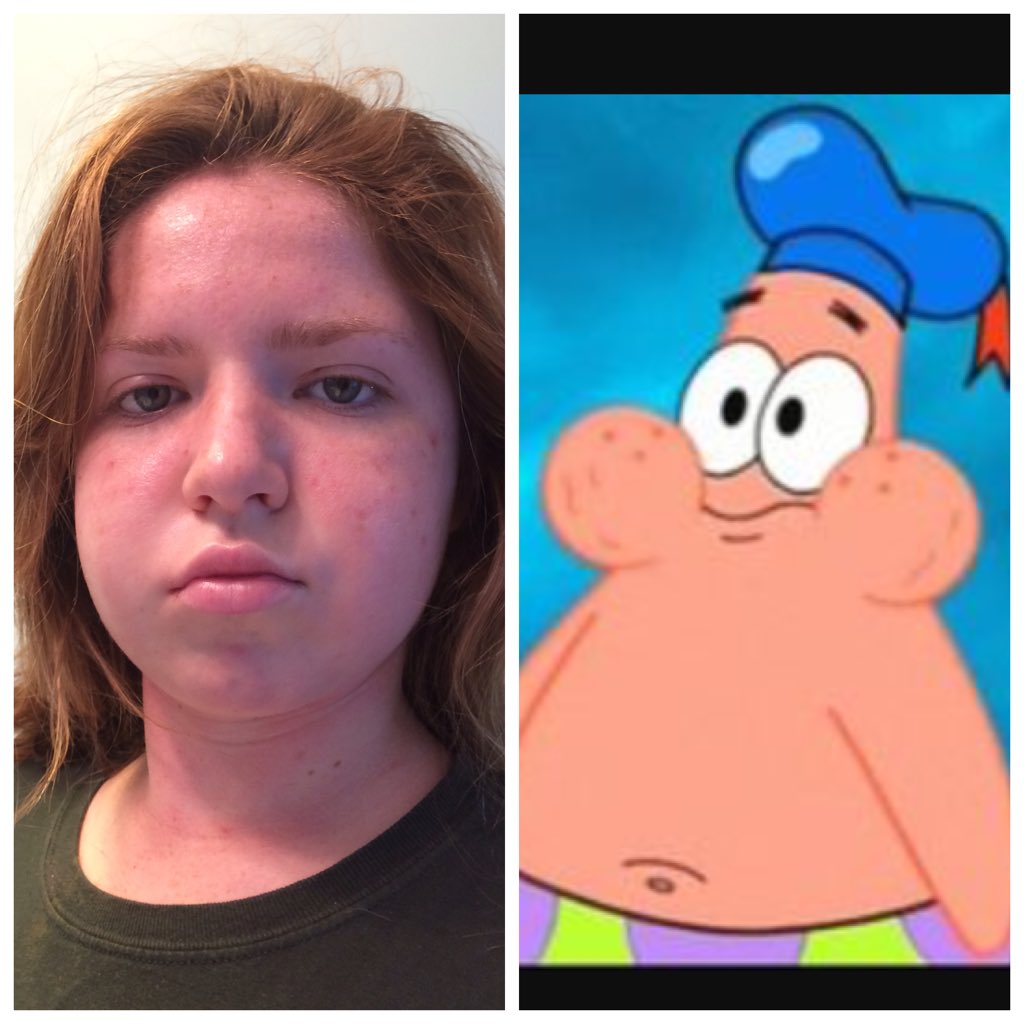 ally_smithwick's tweet image. Incase anyone is having a bad day... #wisdomteethprobs