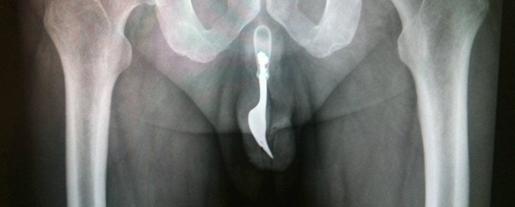 Spunk.nl tweet media