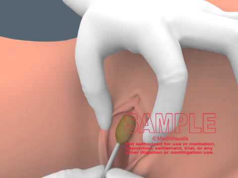 Neil Palin tweet media