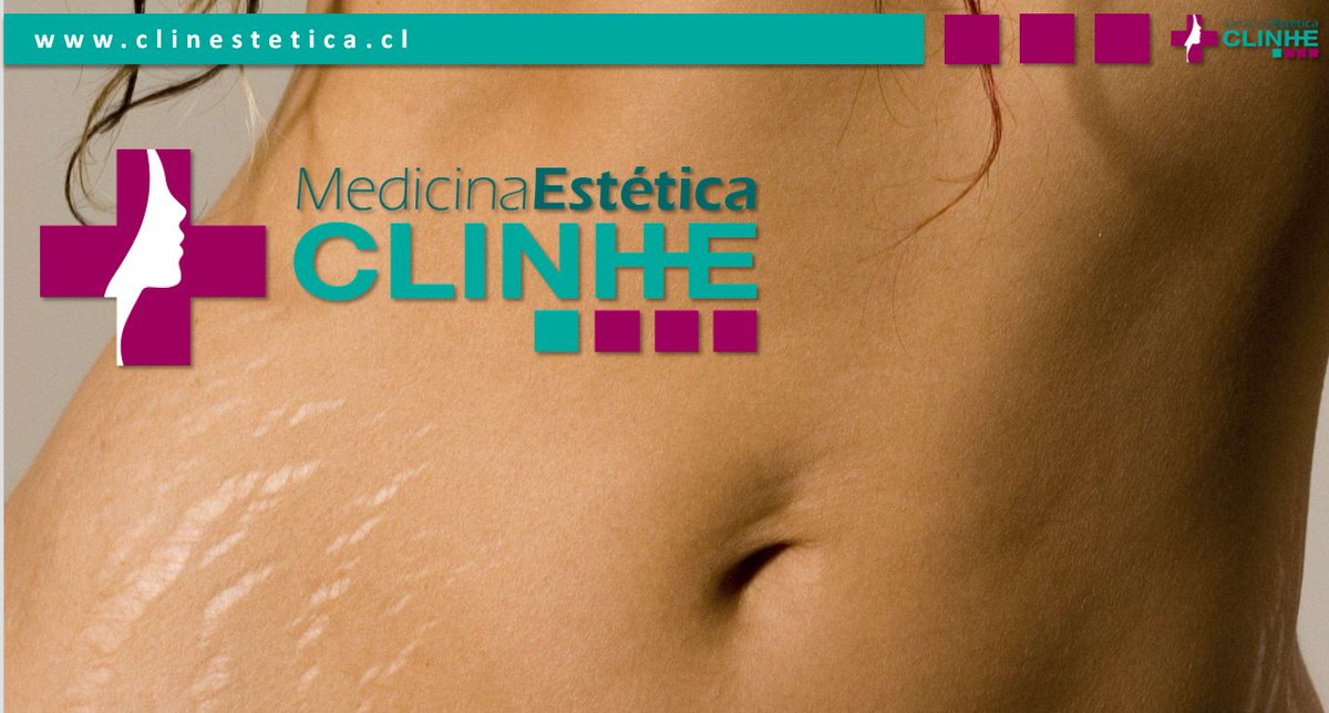 ClinEstetica_cl's tweet photo. #FilosofíaCME q la comunidad se informe sobre las posibildades de mejorar la funcionalidad y aspecto de su piel! 📲👨👧 https://t.co/S2MmMp6415