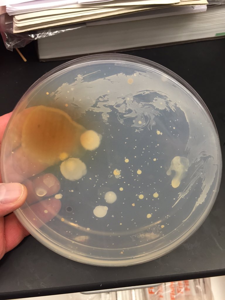 markowenmartin's tweet photo. #Bio350 student combed his beard onto a low nutrient plate. Note the odd patterns in the closeup. #BeardOme https://t.co/H4LXgtDCA8