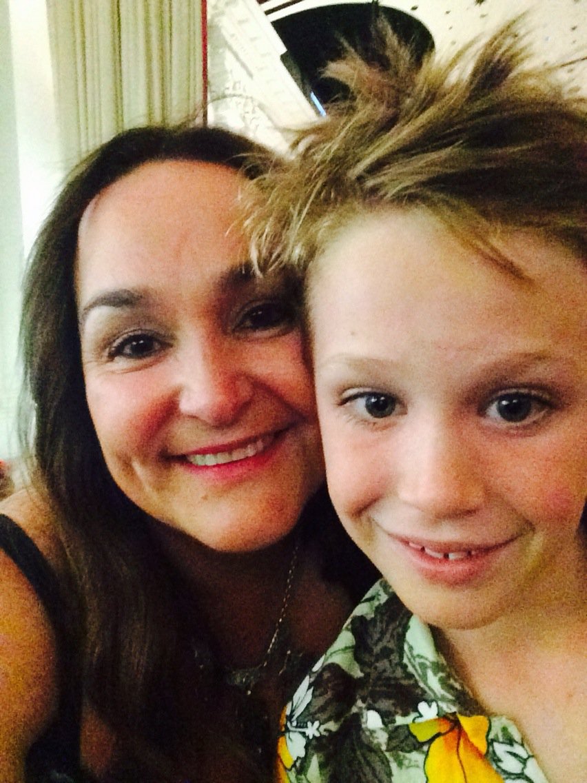 katelangbroek's tweet image. @MrsAndreaMoss @DrChrisMoss me and my boy Artie and our matching scars... But mine is disappearing! #docmagic 👏