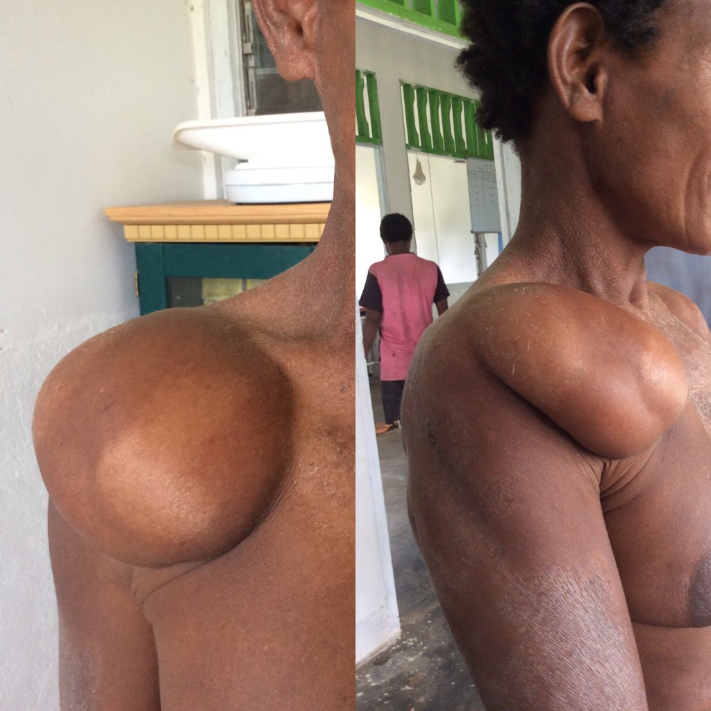soalUKDI's tweet photo. as a gp in a remote, minor surgery and antibiotics in adequate. what are you going to do? https://t.co/BlPtzzxpWq