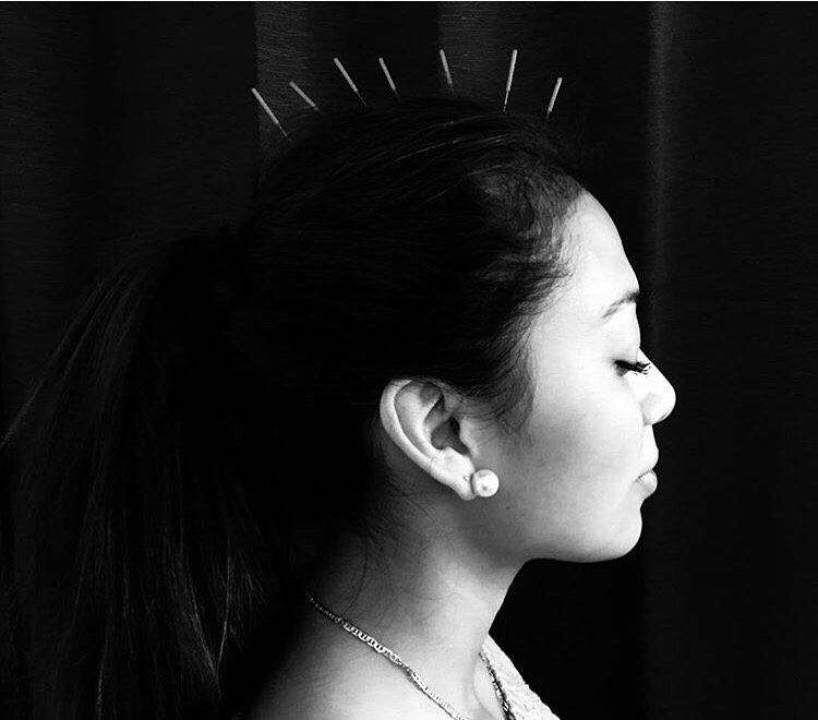 QuietCornerAcu's tweet photo. Acupuncture is a healing technique as well as an art. #repost https://t.co/fudpHkLFJW